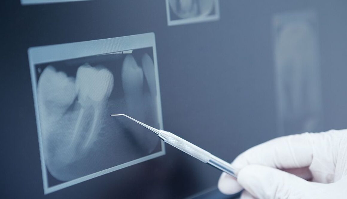 Dentysta Gdańsk – Stomatologia cyfrowa w nowoczesnym wydaniu