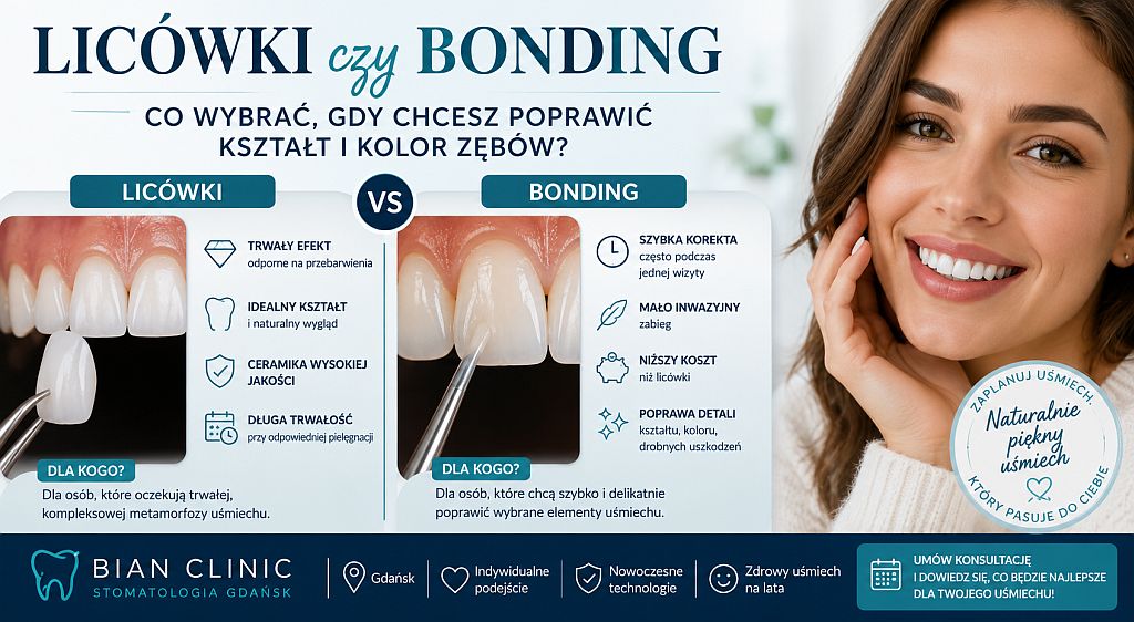 Licówki czy bonding, co wybrać, gdy chcesz poprawić kształt i kolor zębów